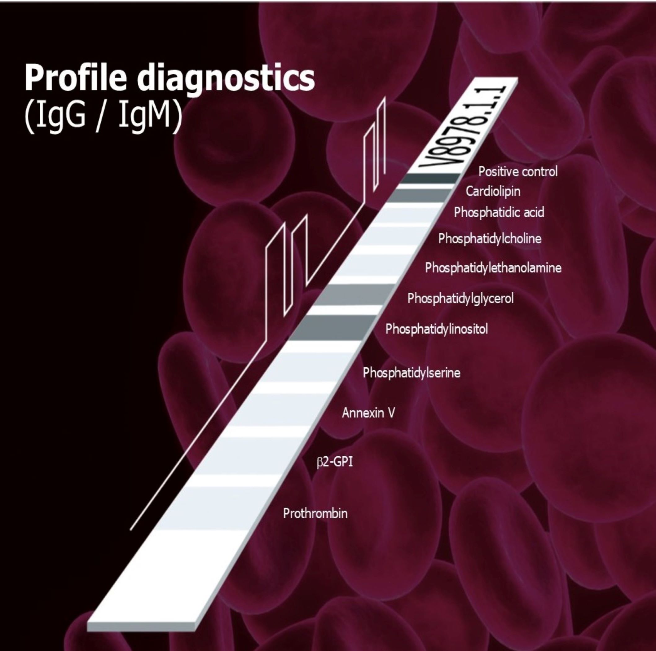 抗磷脂抗体谱（IgG或IgM）10项检测试剂盒（酶联免疫斑点法）