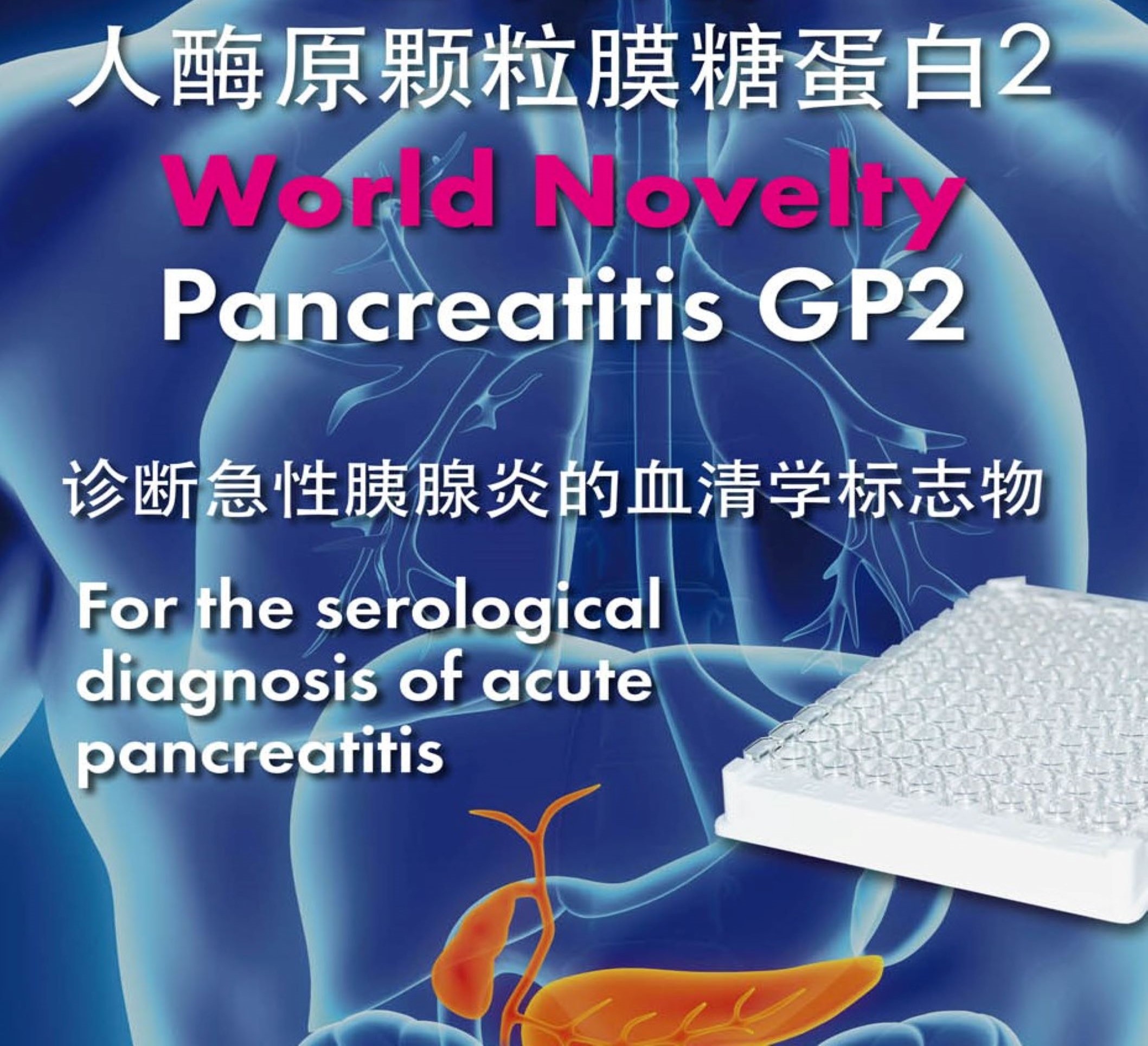 Pancreatitis GP2 人酶源颗粒膜糖蛋白2检测试剂盒